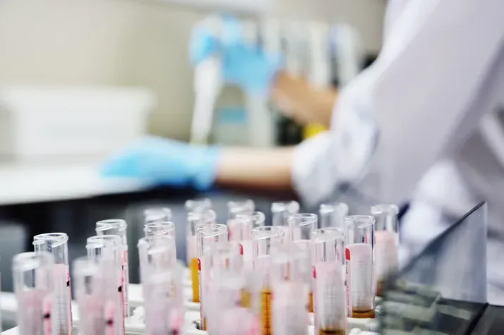 pcr-test-laboratory-research-test-tube