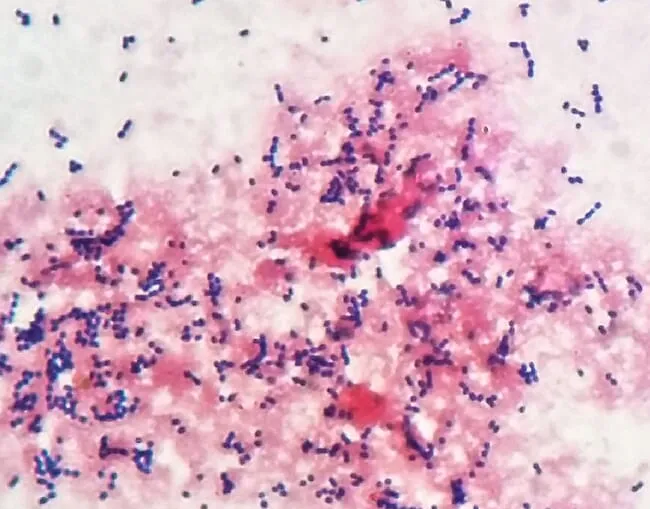 Gram stain of Streptococcus spp showing Gram-positive cocci arranged in chains