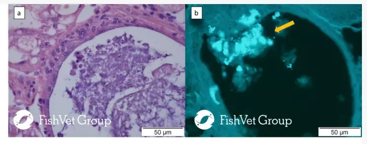 Microsporidians_1