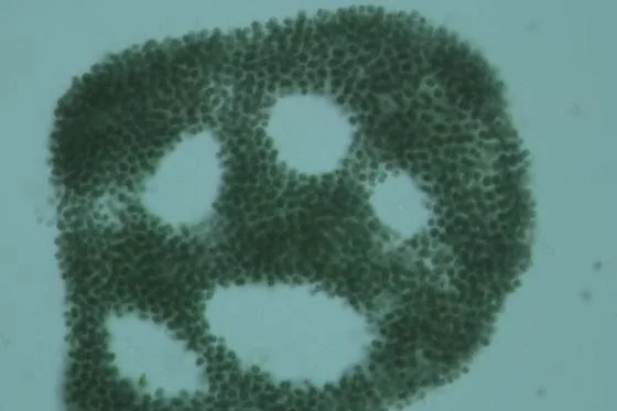 Tảo lam Microcystis